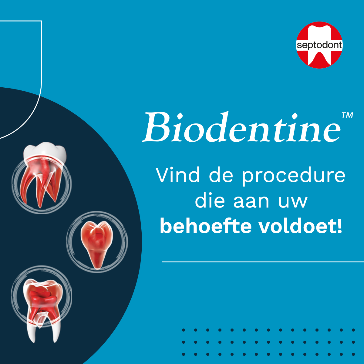 biodentine-clinical-procedure-native-files-NL-1